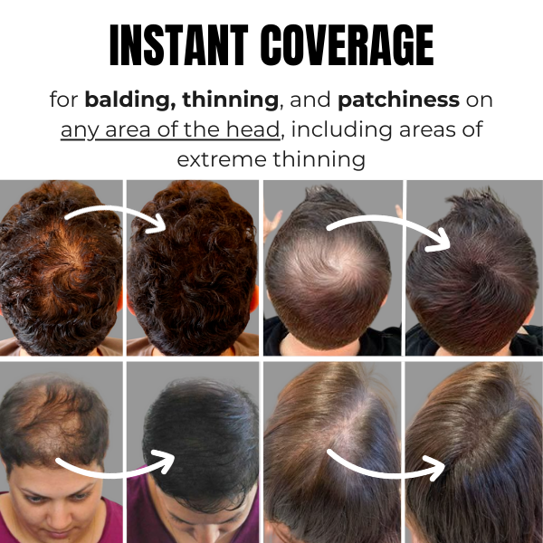 Hair Loss Powder